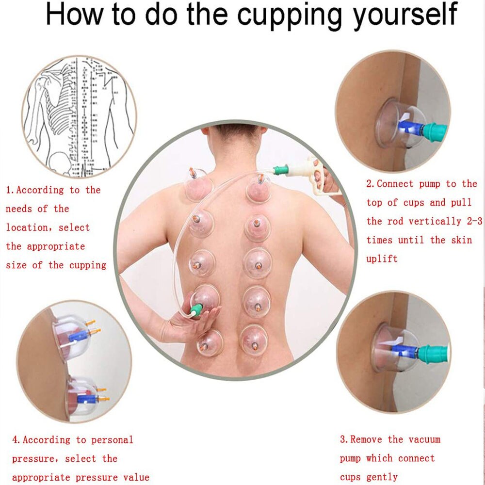 Ensemble de Thérapie CUPPING  Tasses Ventouse chinoises